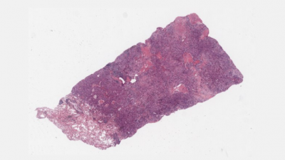 Case 5