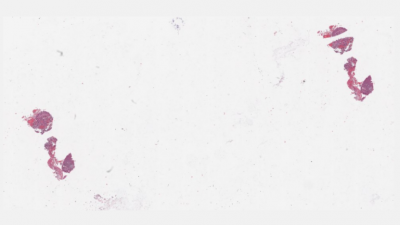 Case 6