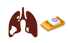 Tumour tissue