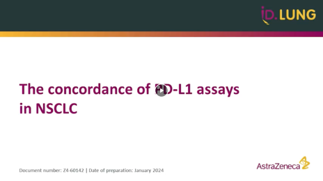 The concordance of PD-L1 assays in NSCLC