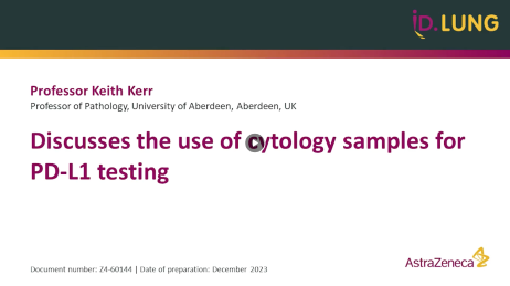 The use of cytology simples for PD-L1 testing