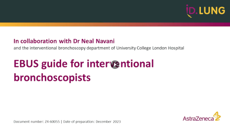 EBUS guide for interventional bronchoscopists