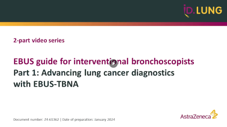 EBUS guide for interventional bronchoscopists part 1