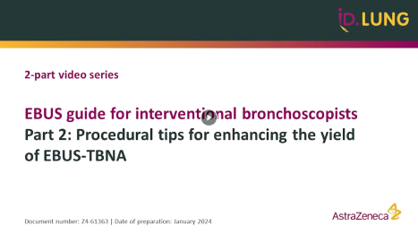 EBUS guide for interventional bronchoscopists part 2