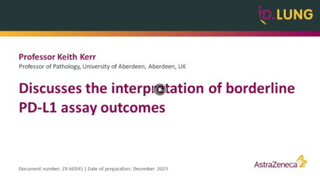 The issue of borderline PD-L1 expression interpretation