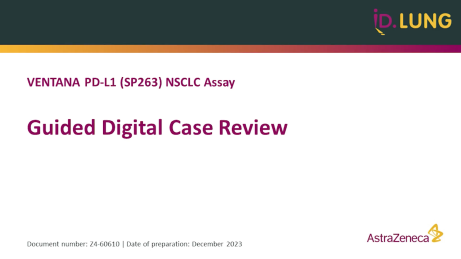 VENTANA PD-L1 (SP263) NSCLC Assay guided digital case review