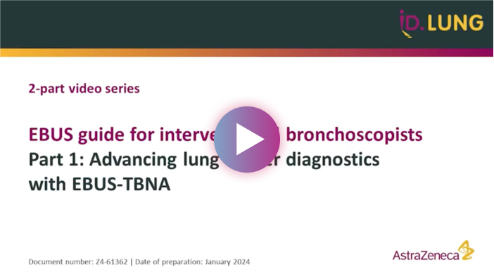 EBUS guide for interventional bronchoscopists part 1