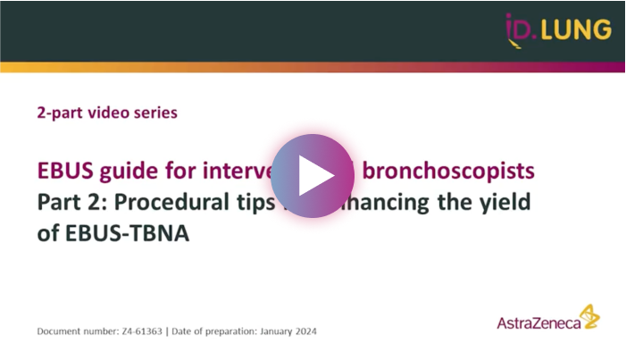 EBUS guide for interventional bronchoscopists part 2