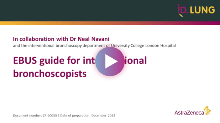 EBUS guide for interventional bronchoscopists